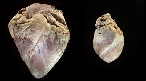 are cow hearts similar to human hearts
